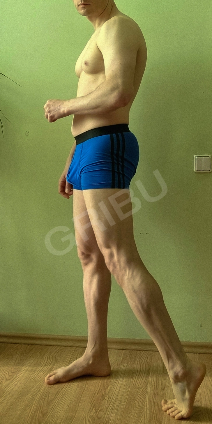 Advertisement (8817014) - Limacharlei 1