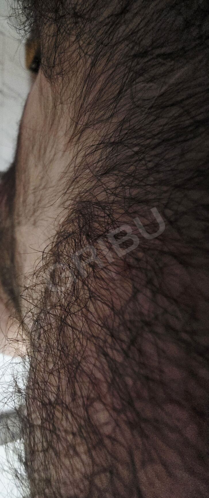 Advertisement (8811309) - Bearrr35 1