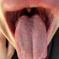 69BJ